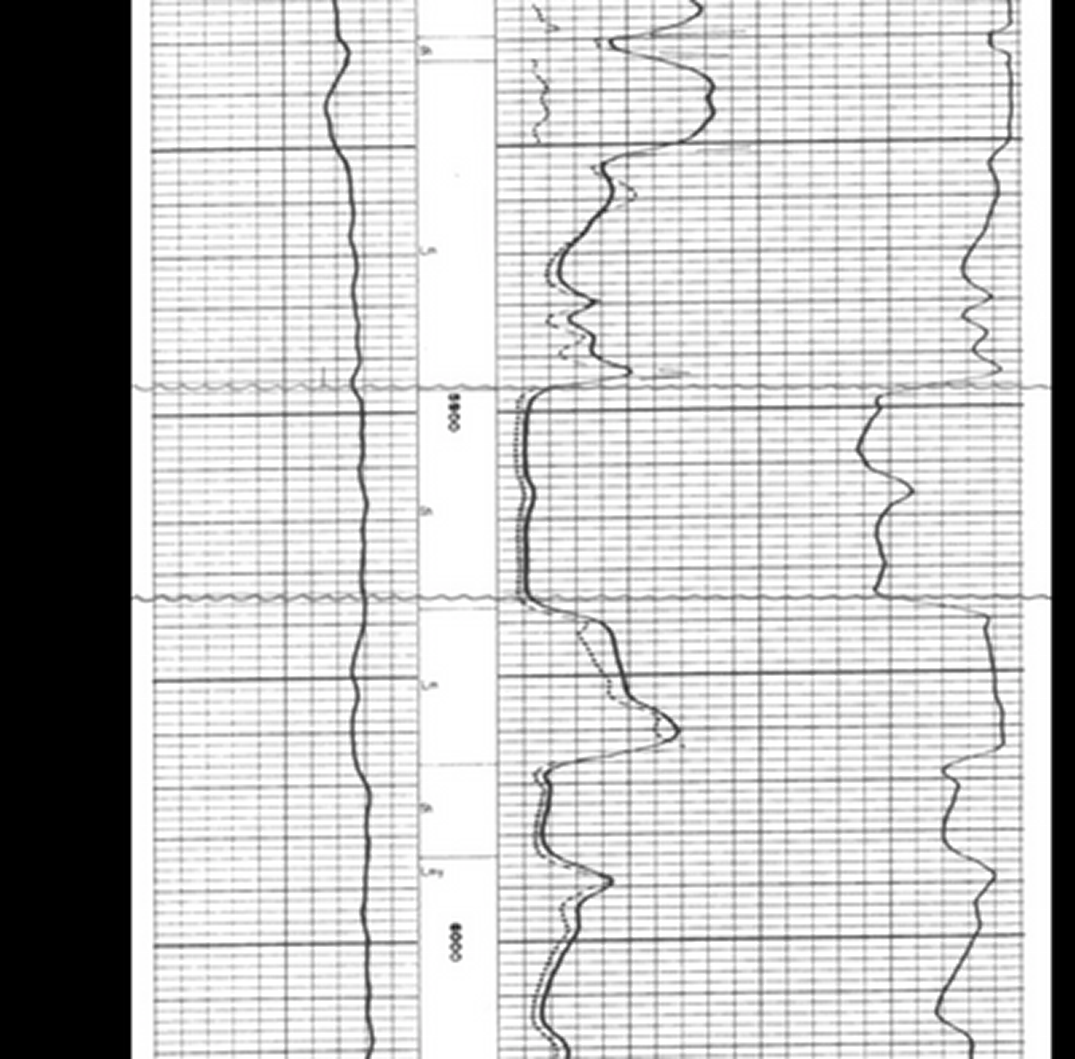 Isopach of Morrowan Shale Log